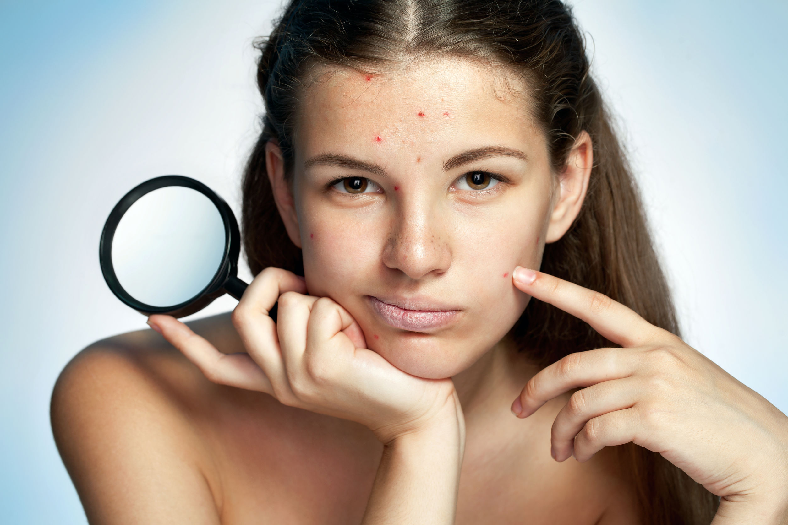 Skin Surface
